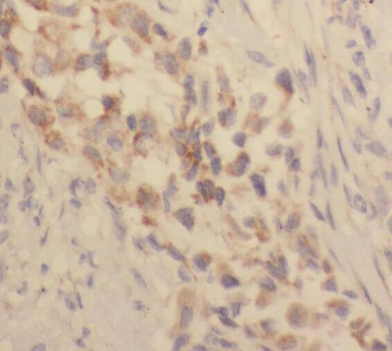 TACC2 Antibody - BSA Free