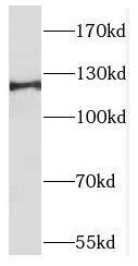 TACC1 Antibody - BSA Free