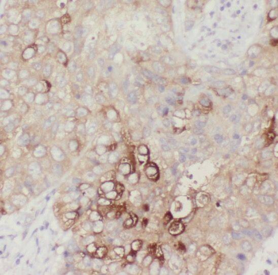 SLC38A3 Antibody - BSA Free