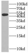 SLC37A4 Antibody - BSA Free