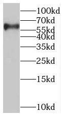 glycerol-3-phosphate permease Antibody - BSA Free