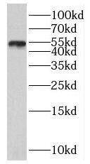 SLC30A6 Antibody - BSA Free