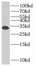 SLC25A45 Antibody - BSA Free