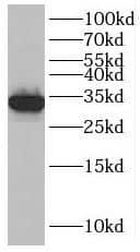 SLC25A34 Antibody - BSA Free