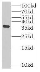 SLC25A33 Antibody - BSA Free