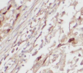 SLC25A3 Antibody - BSA Free