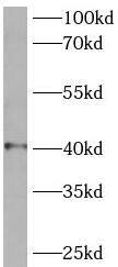SLC25A3 Antibody - BSA Free