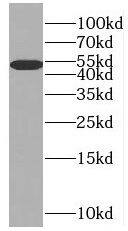 SLC25A25 Antibody - BSA Free