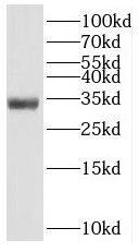 SLC25A2 Antibody - BSA Free