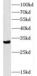 SLC25A18 Antibody - BSA Free