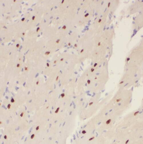 SLC25A15 Antibody - BSA Free