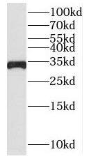 SLC25A15 Antibody - BSA Free