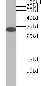 SLC25A10 Antibody - BSA Free