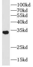 SLC25A1 Antibody - BSA Free
