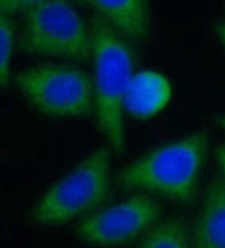 SLC25A1 Antibody - BSA Free