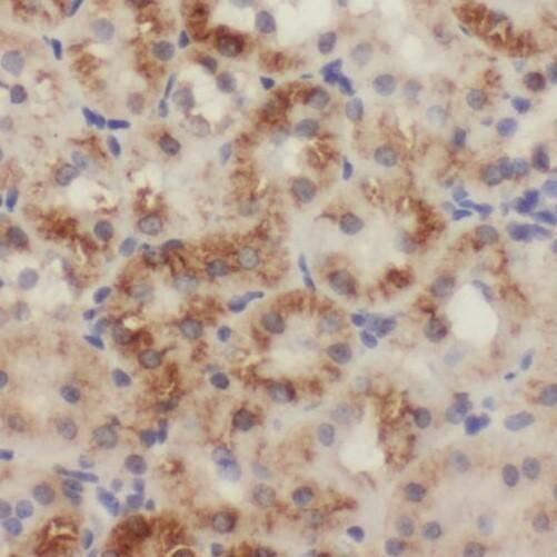 SLC25A1 Antibody - BSA Free