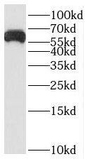SLC24A6 Antibody - BSA Free