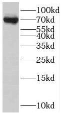 SLC22A23 Antibody - BSA Free