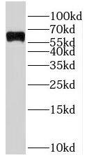 SLC22A15 Antibody - BSA Free