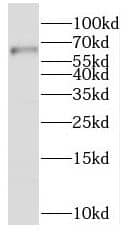 SLC19A3 Antibody - BSA Free