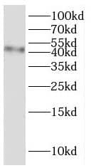 Sialin/SLC17A5 Antibody - BSA Free