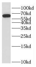 Slain2 Antibody - BSA Free