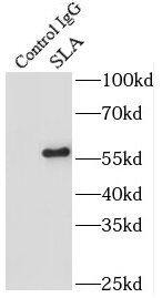 Soluble Liver/Pancreas Antigen Antibody - BSA Free