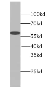 Soluble Liver/Pancreas Antigen Antibody - BSA Free