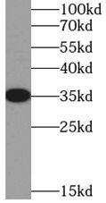 SIX2 Antibody - BSA Free