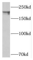 SIPA1L1 Antibody - BSA Free