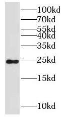 SIKE1 Antibody - BSA Free