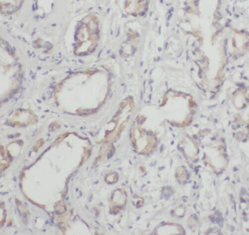 CARKL Antibody - BSA Free