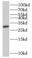 SHOX Antibody - BSA Free