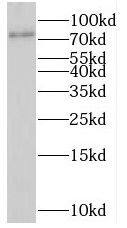 SHKBP1 Antibody - BSA Free