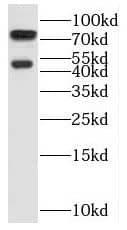 SH3BP1 Antibody - BSA Free