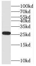 SH3BGR Antibody - BSA Free