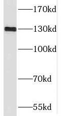 SGSM1 Antibody - BSA Free