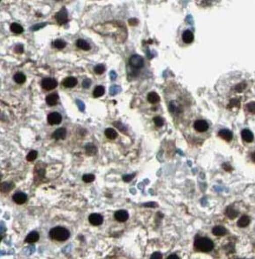 CCDC101 Antibody - BSA Free