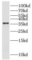 gamma Sarcoglycan Antibody - BSA Free