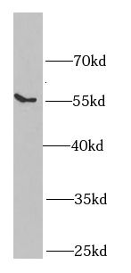 epsilon-Sarcoglycan Antibody - BSA Free
