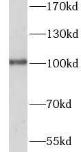 SFMBT2 Antibody - BSA Free