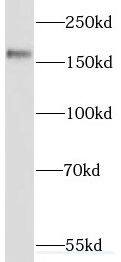SETBP1 Antibody - BSA Free