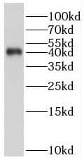 SerpinB9 Antibody - BSA Free
