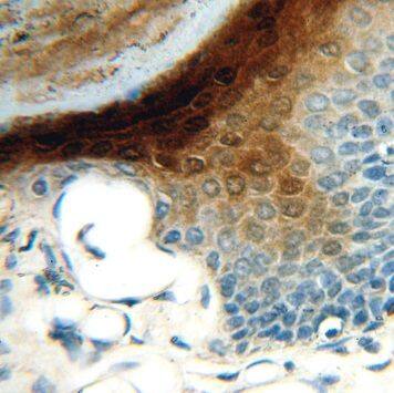 SERPINB13 Antibody - BSA Free