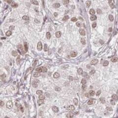 SENP5 Antibody - BSA Free