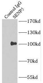SENP5 Antibody - BSA Free
