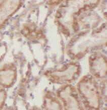 Semenogelin I Antibody - BSA Free