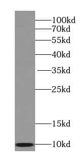 SEC61B Antibody - BSA Free