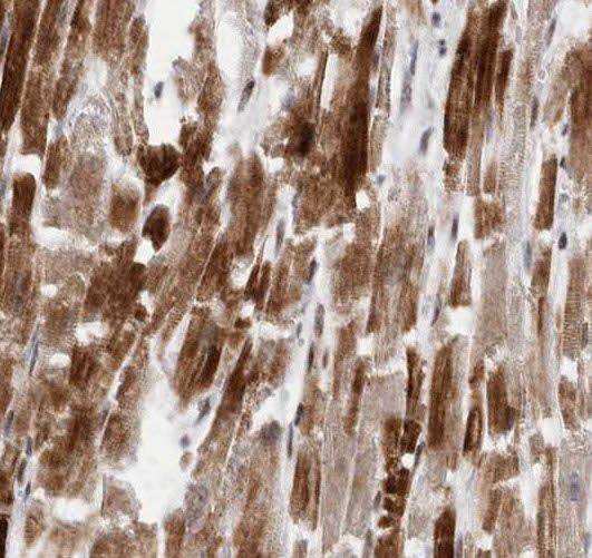 SEC23IP Antibody - BSA Free