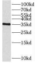 SDR39U1 Antibody - BSA Free